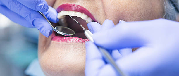 Best Emergency Cosmetic Dentistry (e.g., broken veneers) in Dryden, MI