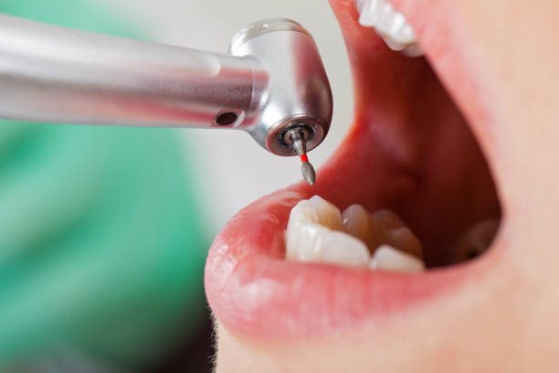 Best Walk-In Emergency Dental Services in Dryden, MI